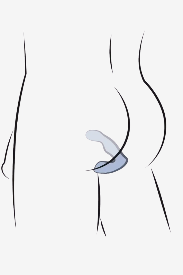 Prostata-Vibrator - Ø 3,6 cm | 14,4 cm